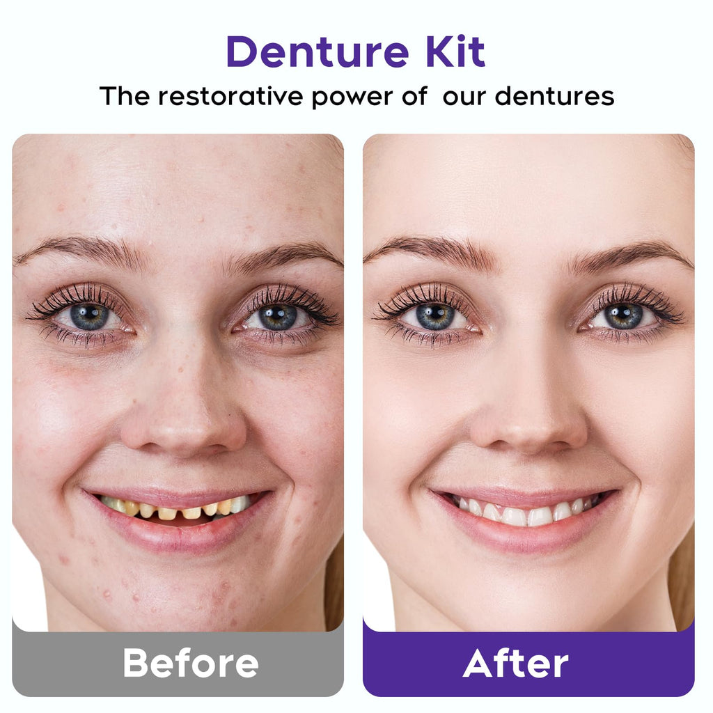 DIY Denture Kit for Upper & Lower Teeth G2362